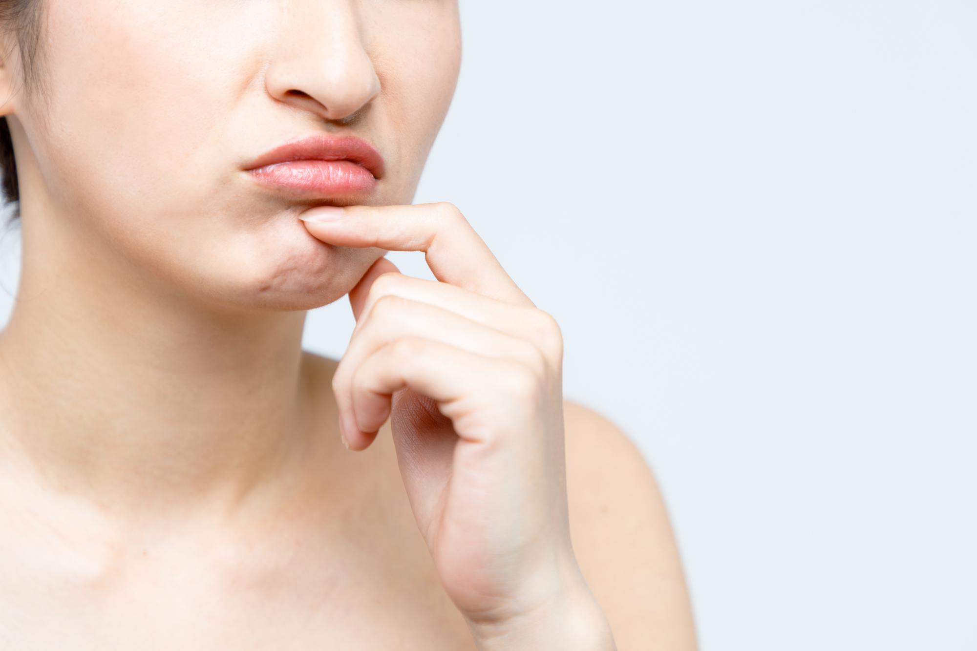 新生児の唇が慢性的に荒れている場合はどうすればよいですか?