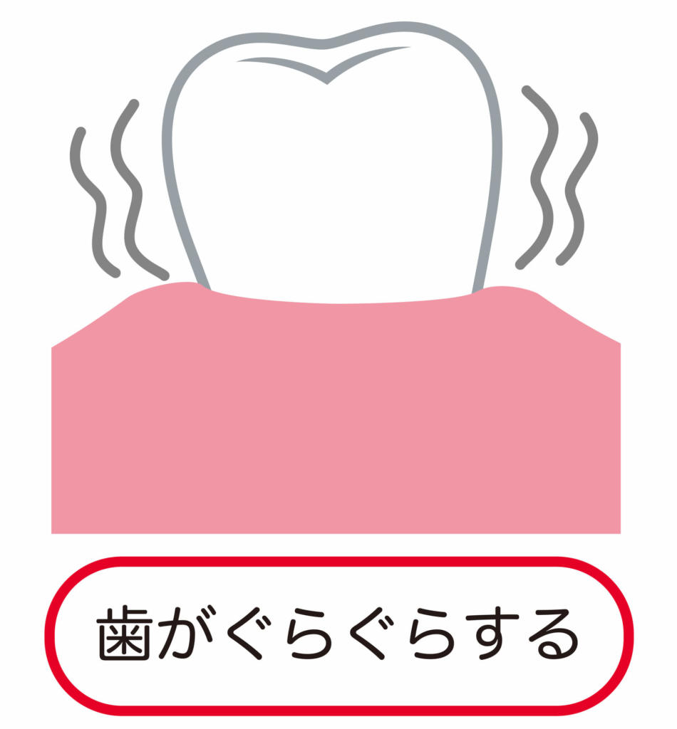 歯がぐらぐらするのイラスト